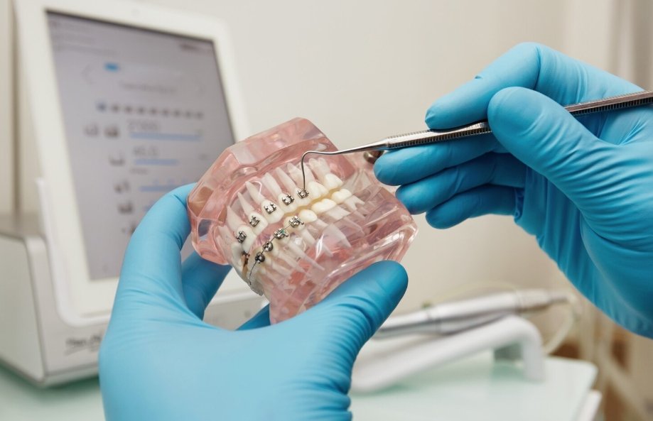 Application of ultra-fine wires in dental tools