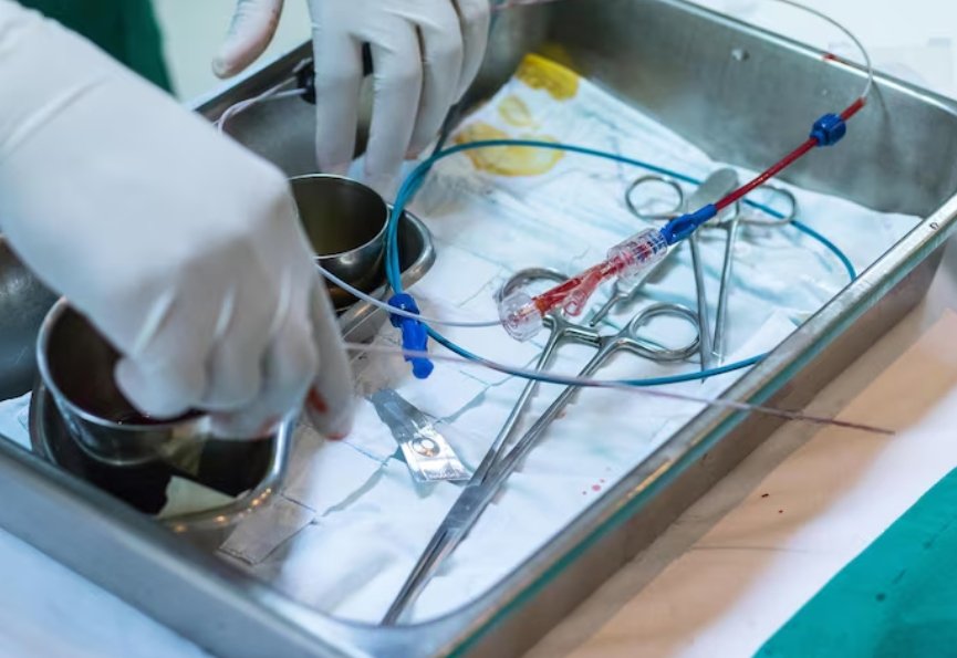 Demand for Ultra-Fine Wires in Diagnostic Catheters