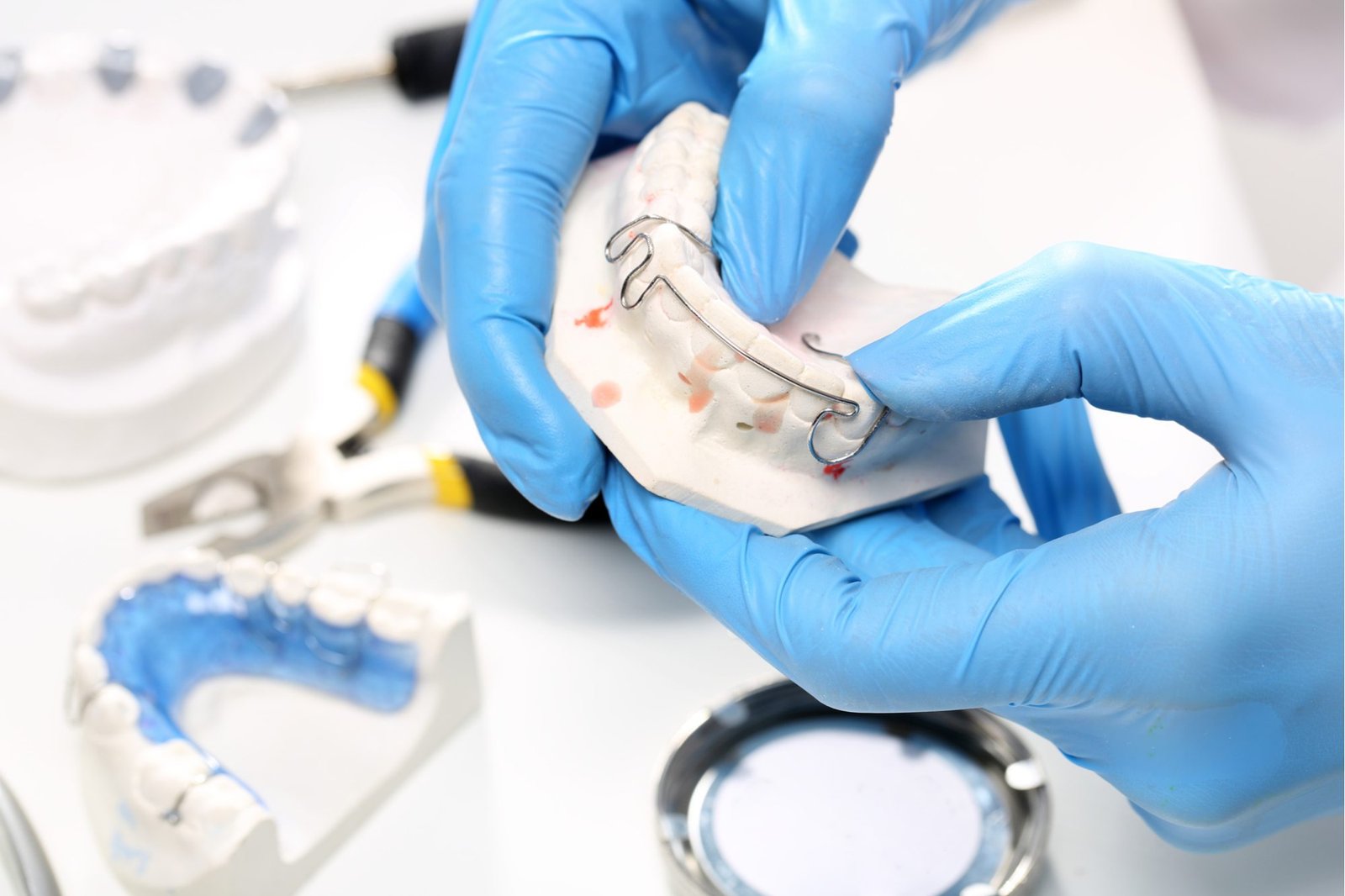 Specialized Profile Wires and Multi-Strand Designs for Complex Dental Applications
